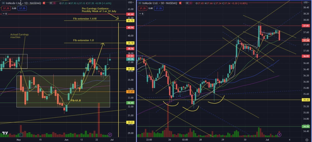 INMD Pre-earnings guidance coming up! How will it react?