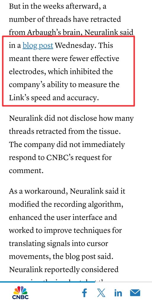 Media reported bias negatively about Elon Musk's Neuralink