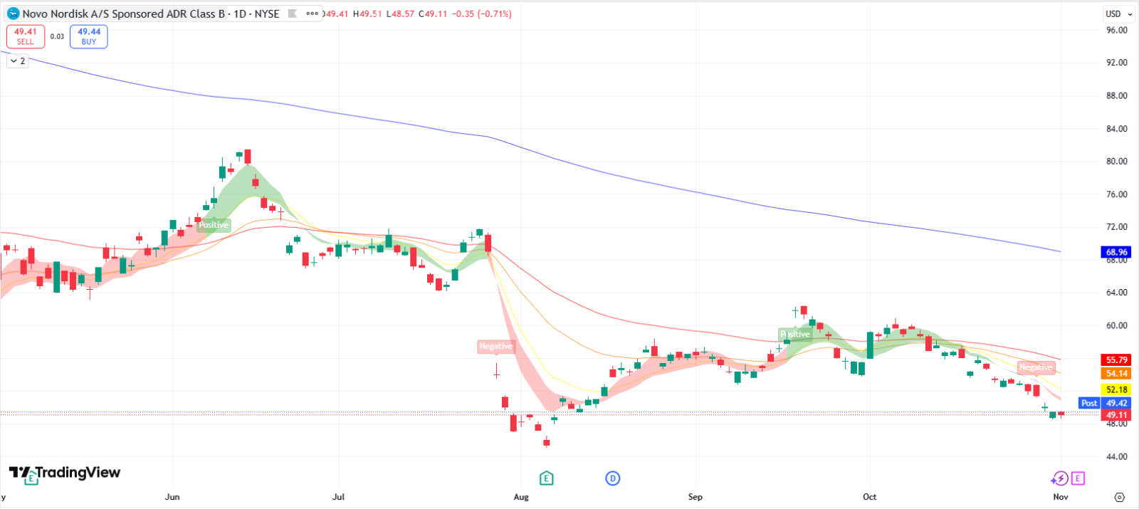 Novo Nordisk (NVO) Sales Momentum and Navigating Competition Key To Earnings