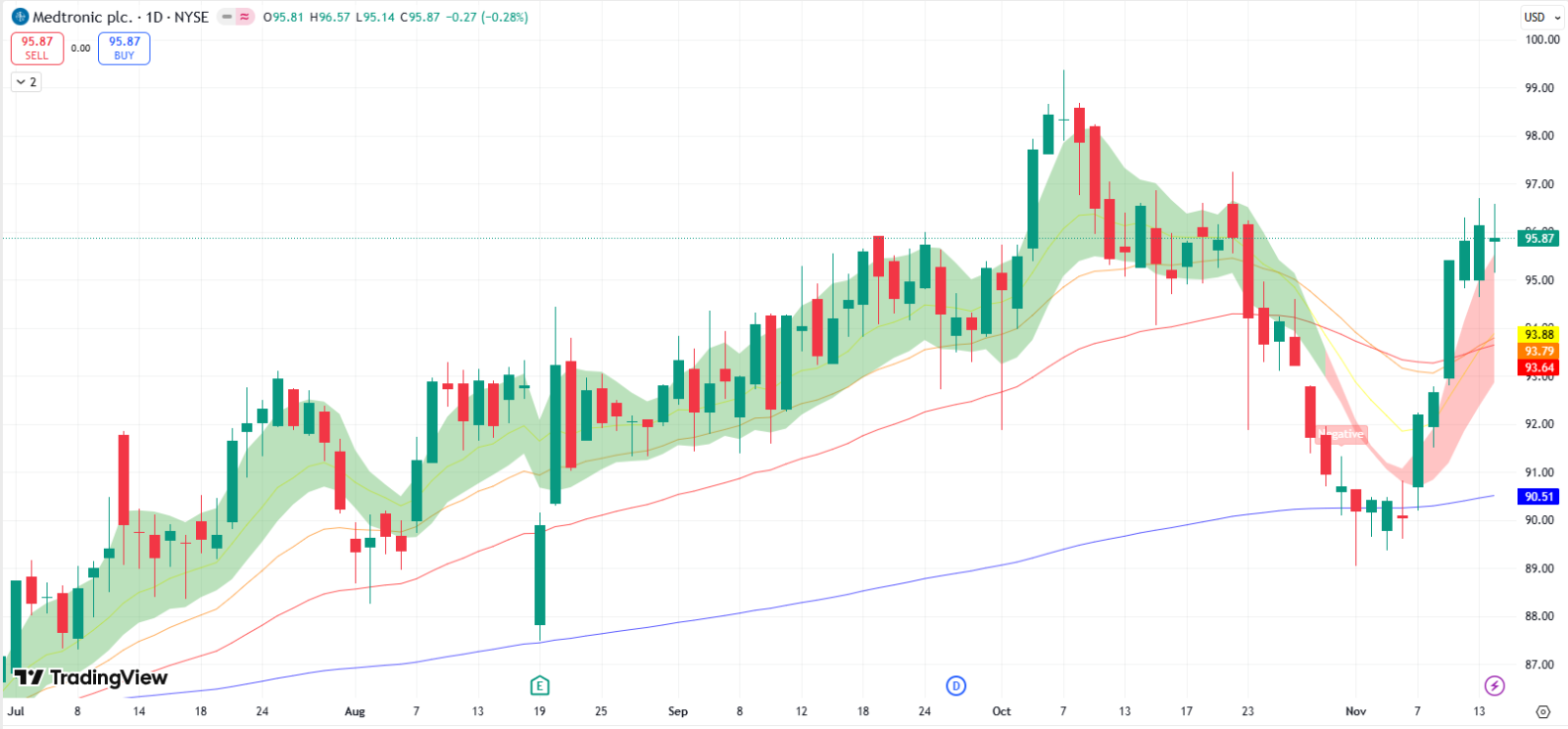 Would You Consider Medtronic (MDT) Earnings Play To Hedge?