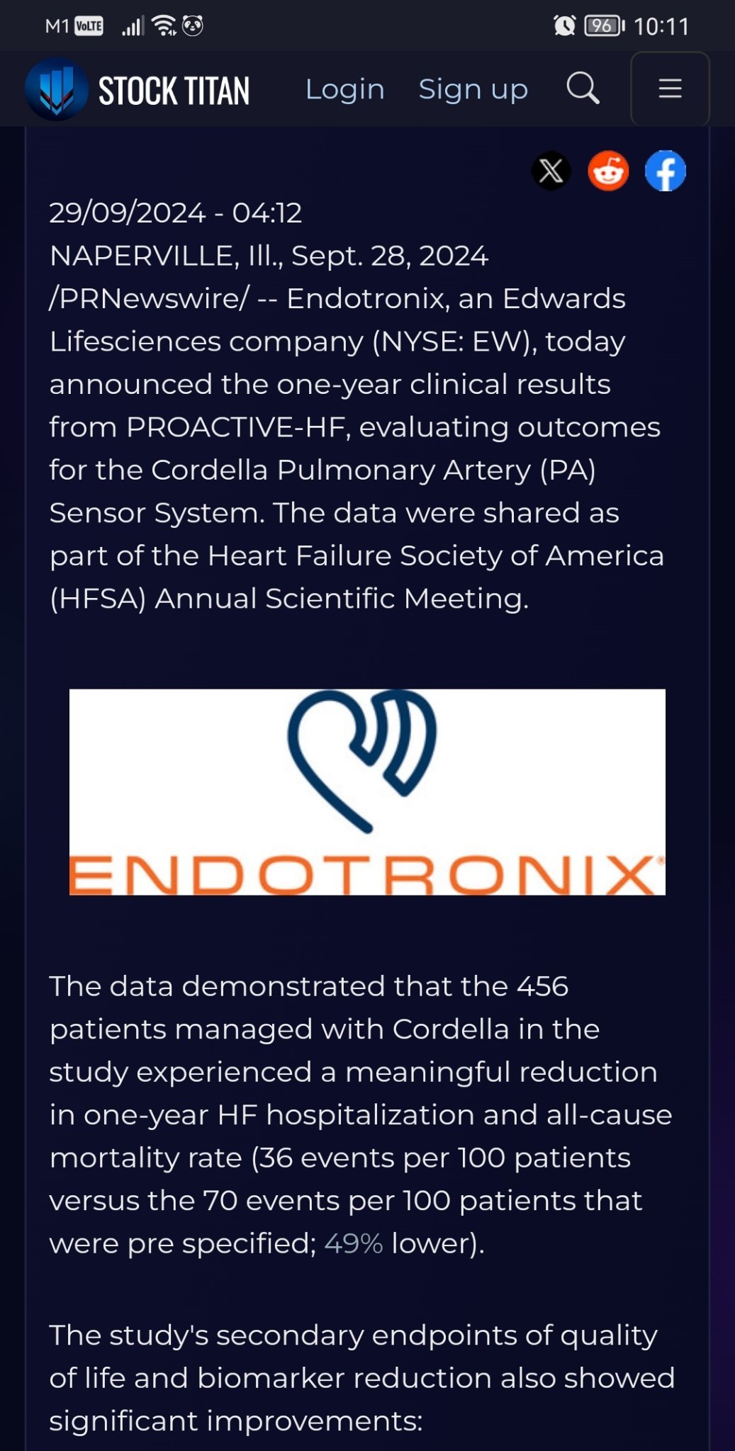 ONE-YEAR DATA SHOW EXCELLENT OUTCOMES FOR ENDOTRONIX CORDELLA PULMONARY ARTERY SENSOR SYSTEM