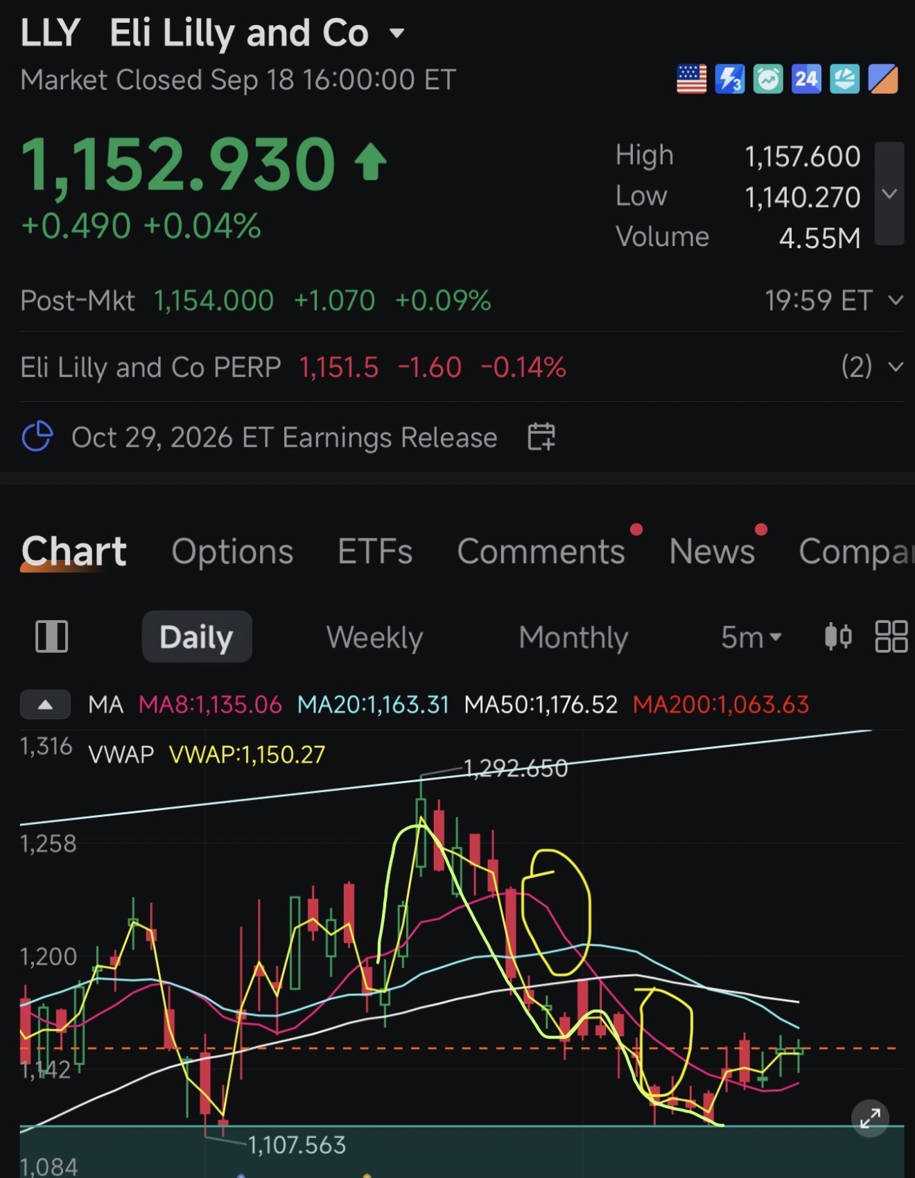 วิธีเทรด Cash Secured Puts