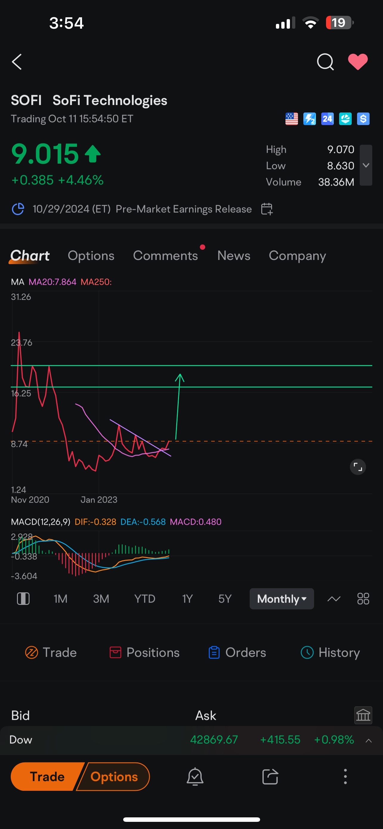 SoFi’s Potential Long Setup