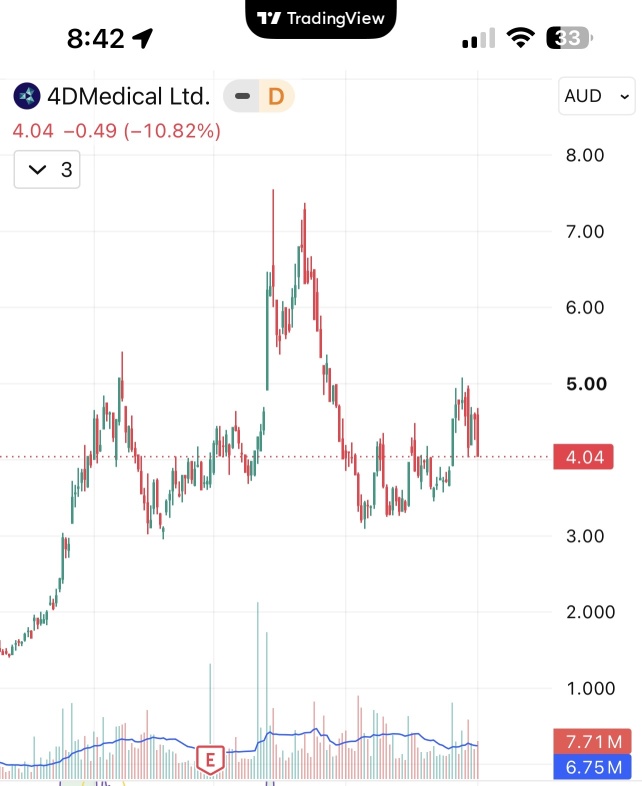 head and shoulders?