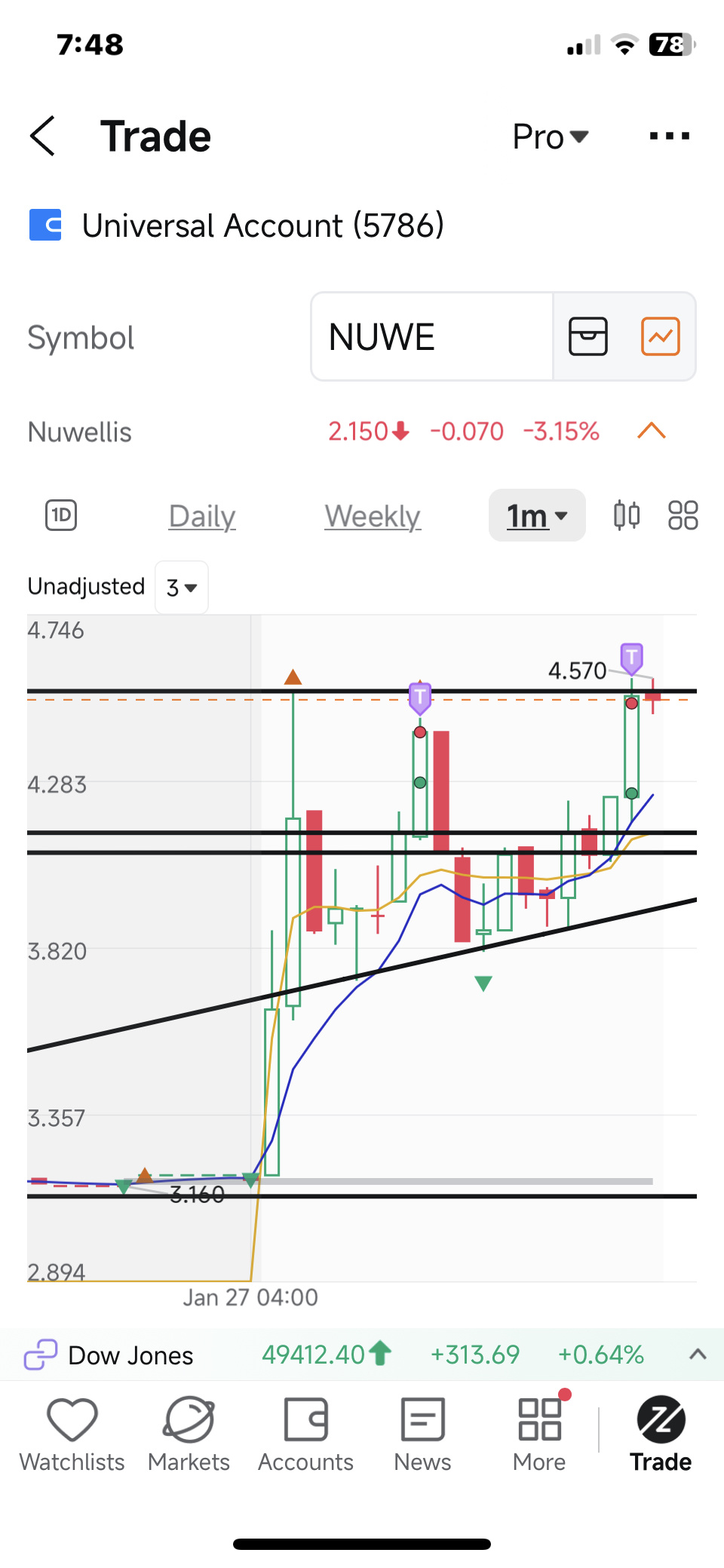 $Nuwellis (NUWE.US)$
