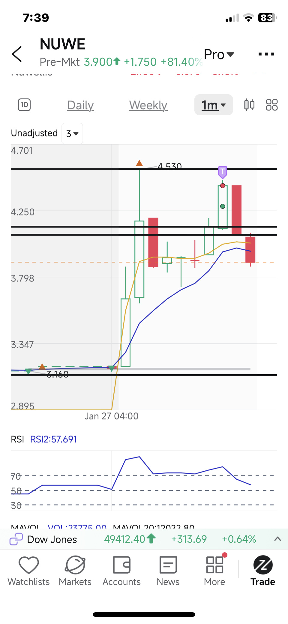 $Nuwellis (NUWE.US)$